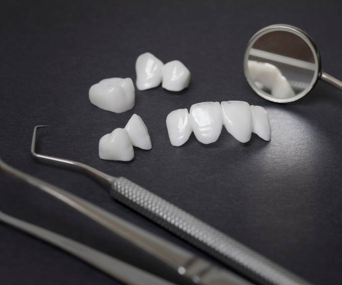 Several white dental crowns and veneers on table next to dental mirrors