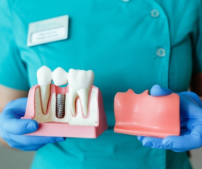 Dentist holding model of gums with no teeth and a model of gums with dental implant and two teeth