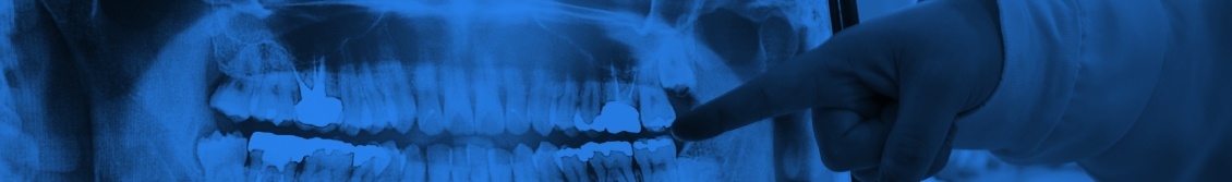 Dentist pointing to x ray of teeth